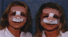 Identical twins who had cosmetic surgery together