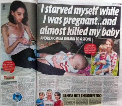 Katy Basset, Anorexia nearly killed me and my unborn baby